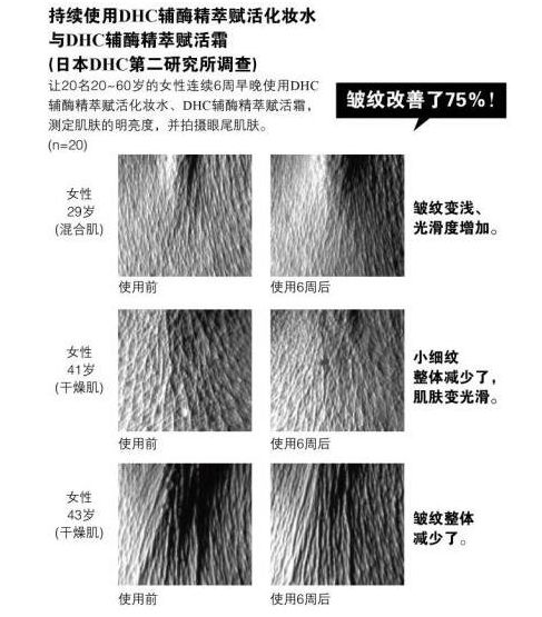 击退皱纹烦恼 DHC黄金霜开创2016秋冬护肤抗衰老新势力